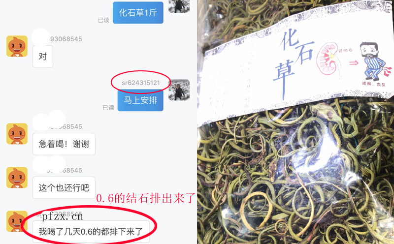 化石草有效排石案例圖片